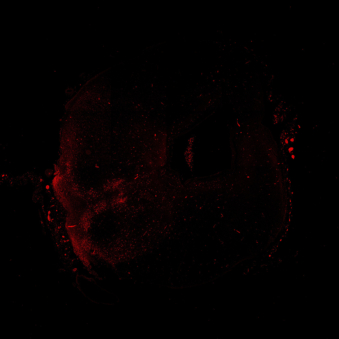 Human foetal midbrain